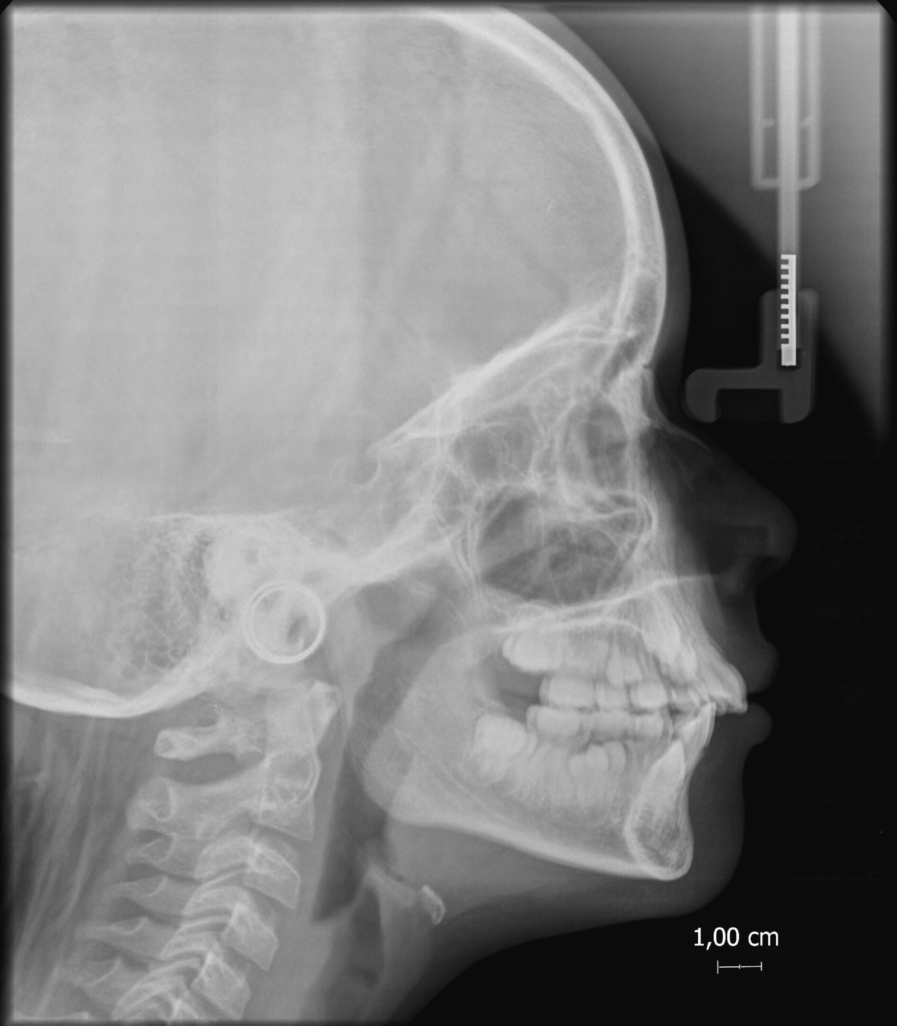 rx